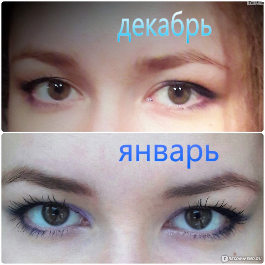 народный метод избавления от глистов народный метод избавления от глистов