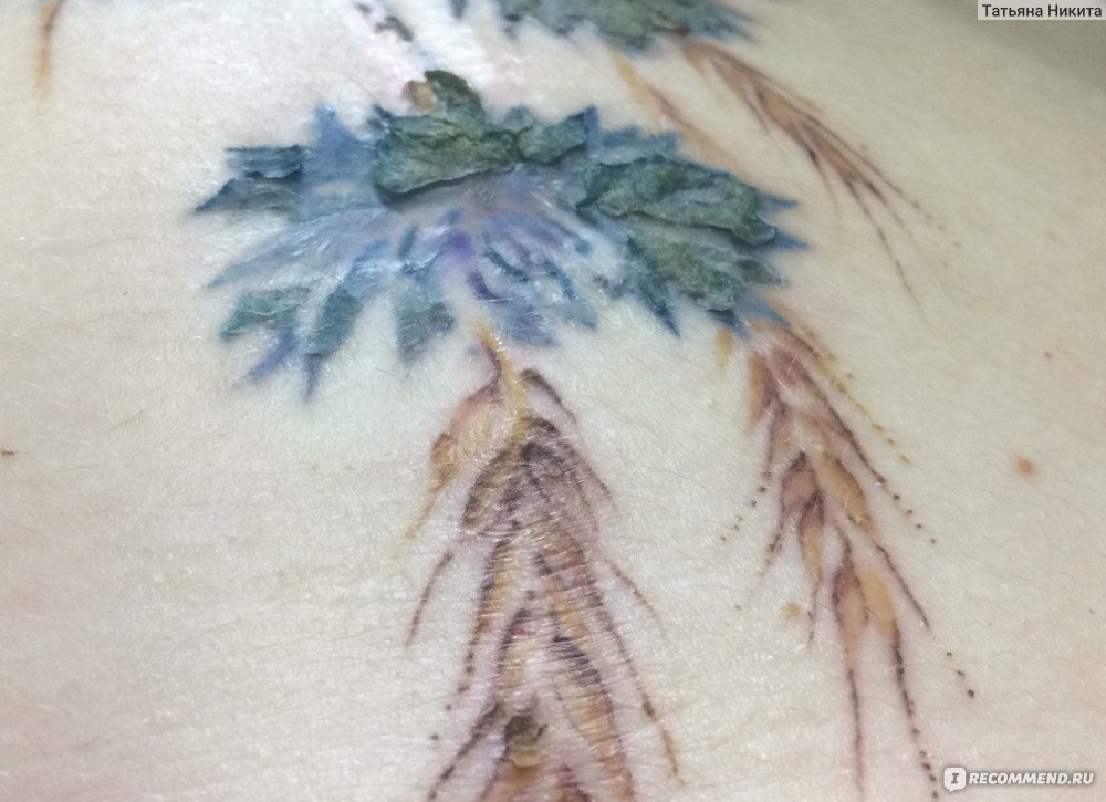 Воспаление татуировки: симптомы и признаки заражения тату – Онлайн-журнал о тату