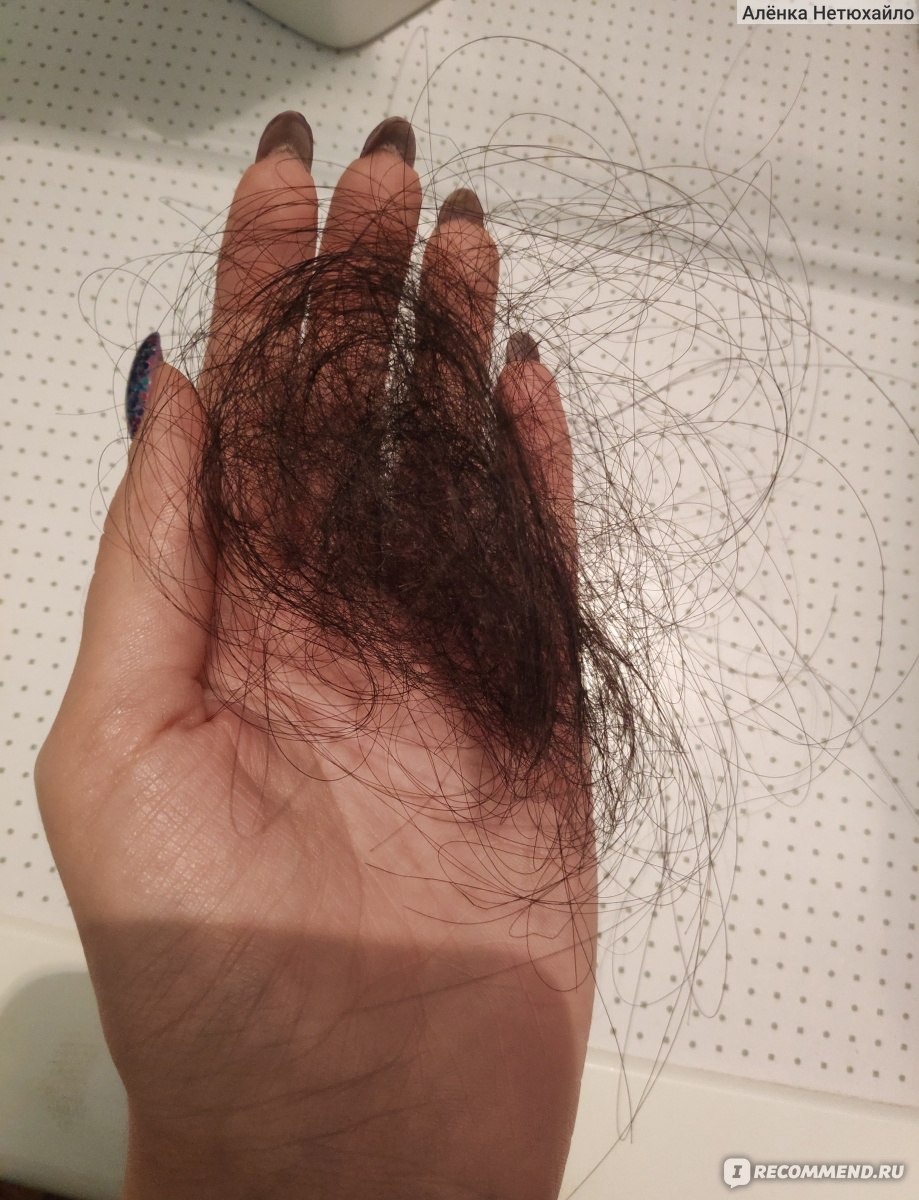 Почему выпадают волосы при мытье головы. Норма выпадения волос.