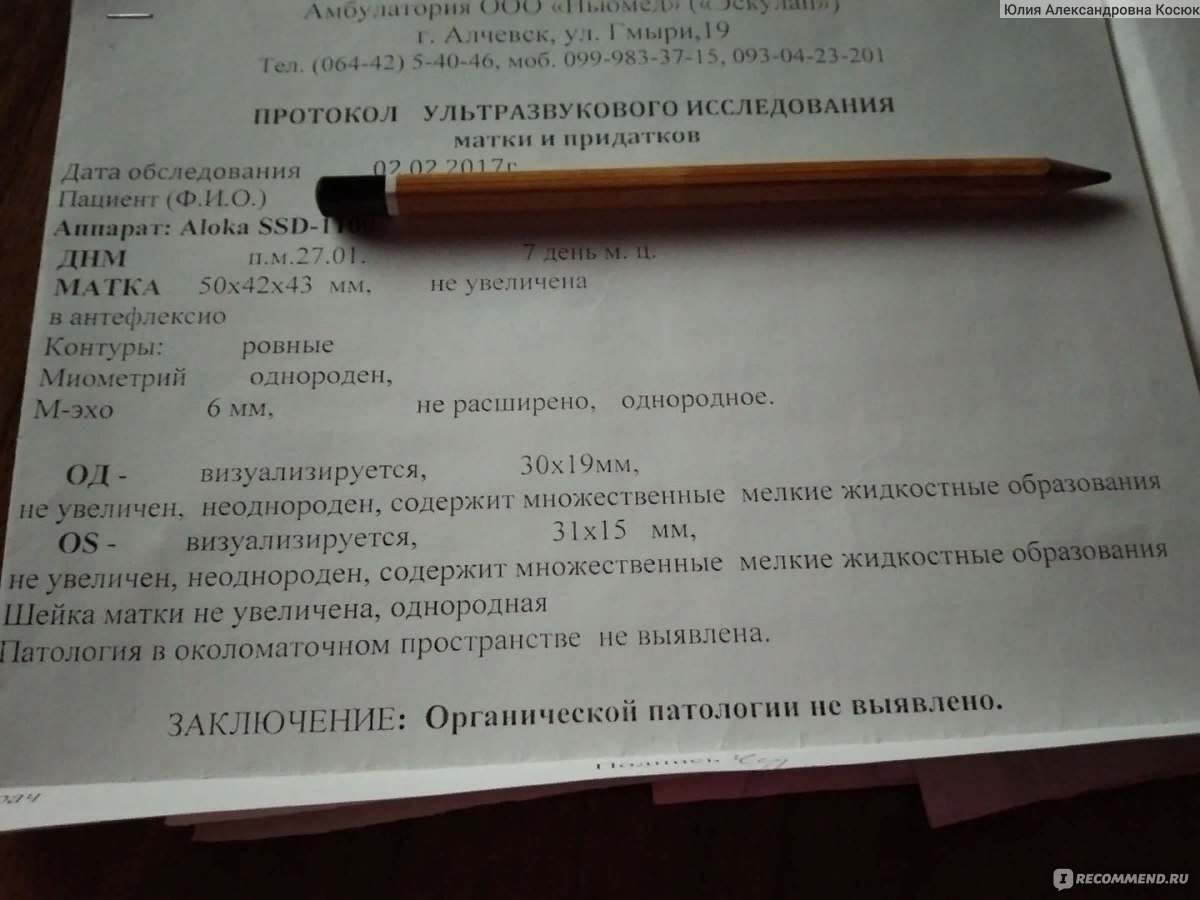 Трансабдоминальное УЗИ органов малого таза - «Эндокринолог, отправил на узи  малого таза.» | отзывы