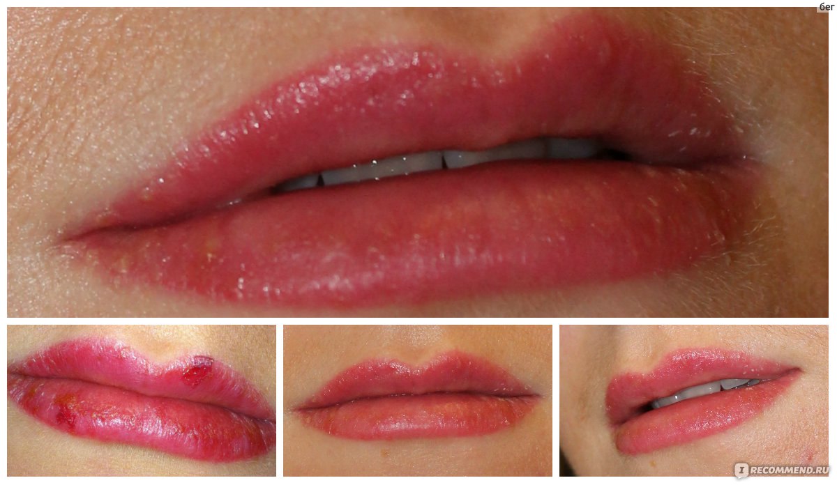 Заживление перманентного макияжа губ по дням фото