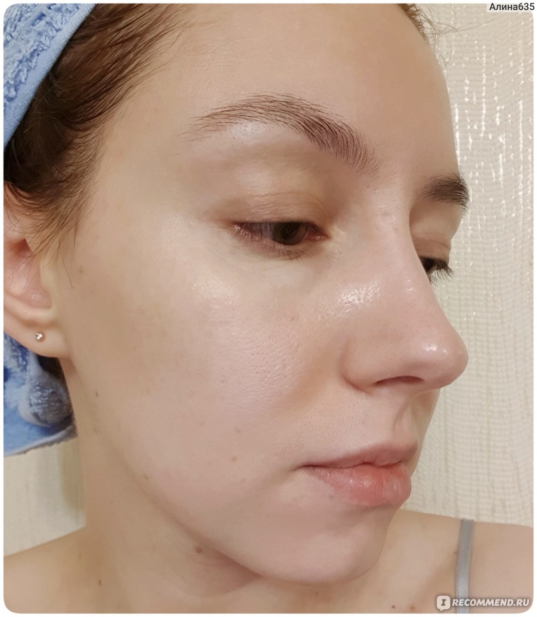 Пилинг для лица So Natural Red peel tingle serum фото