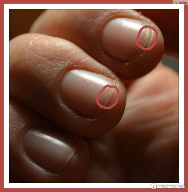На короткие ногти можно наращивать. Маникюр на ногти под корень. Маникюр на обгрызанные ногти. Очень широкие ногти. Наращивание ногтей на обгрызанные ногти.