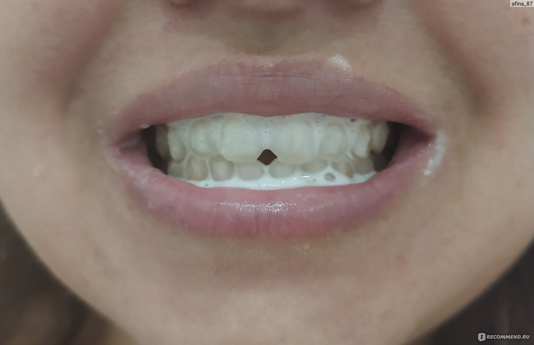 Зубная паста Atomy propolis фото