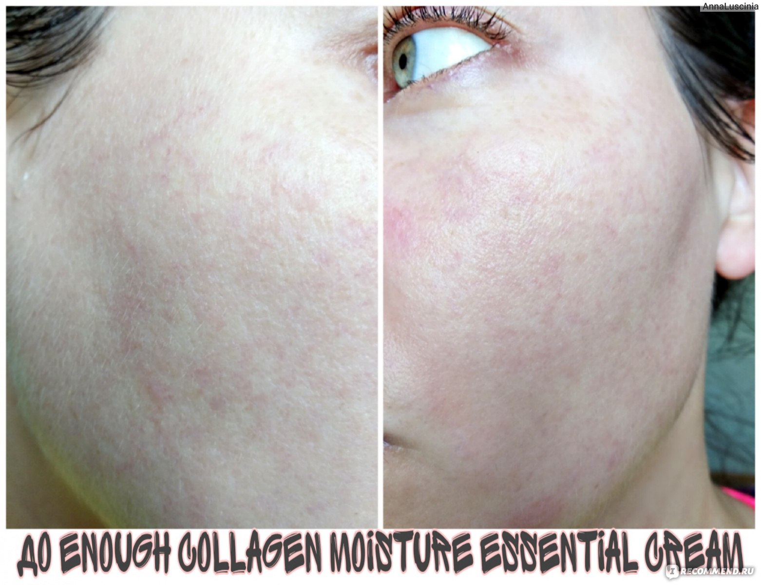 Кожа до нанесения Крем для лица Enough Collagen Moisture Essential Cream.