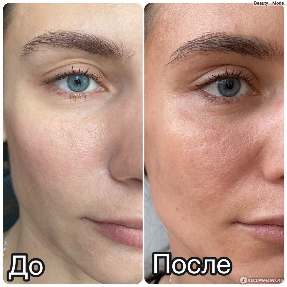Бронзер на лице до и после