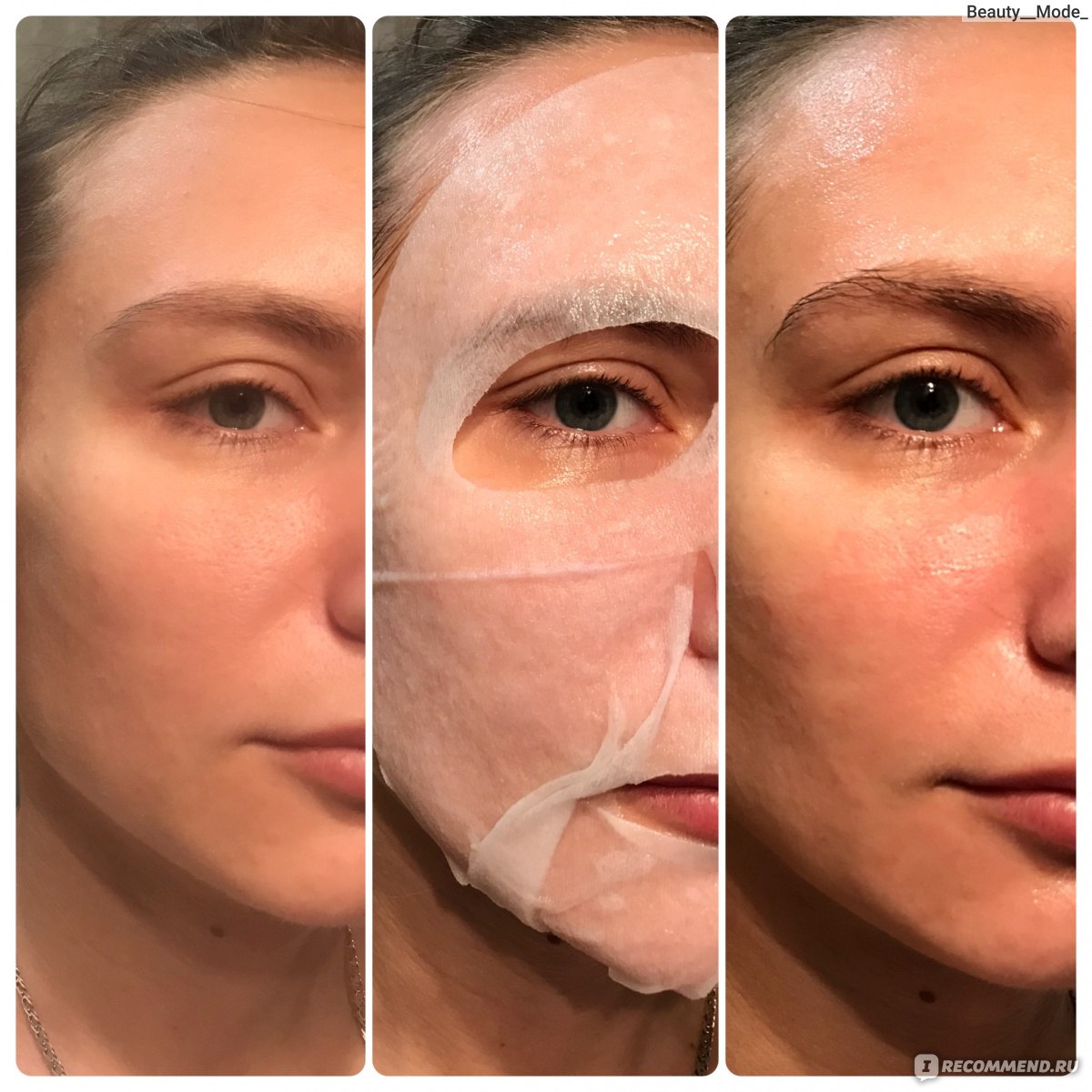 Тканевые маски до и после. Тканевая маска для лица до после. Лицо после тканевой маски. Аллергия на тканевые маски.