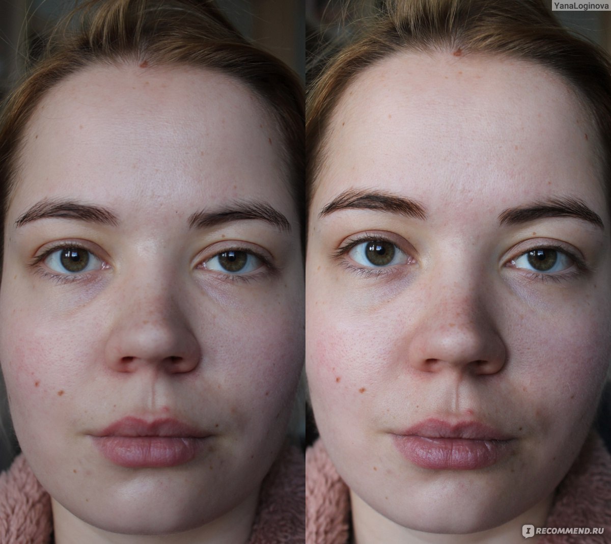 Праймер для лица фото до и после