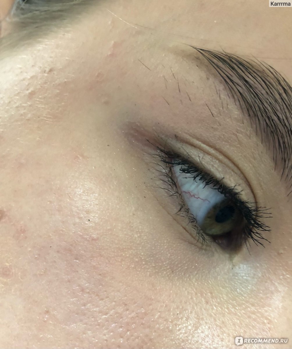 звездатый взгляд отзывы