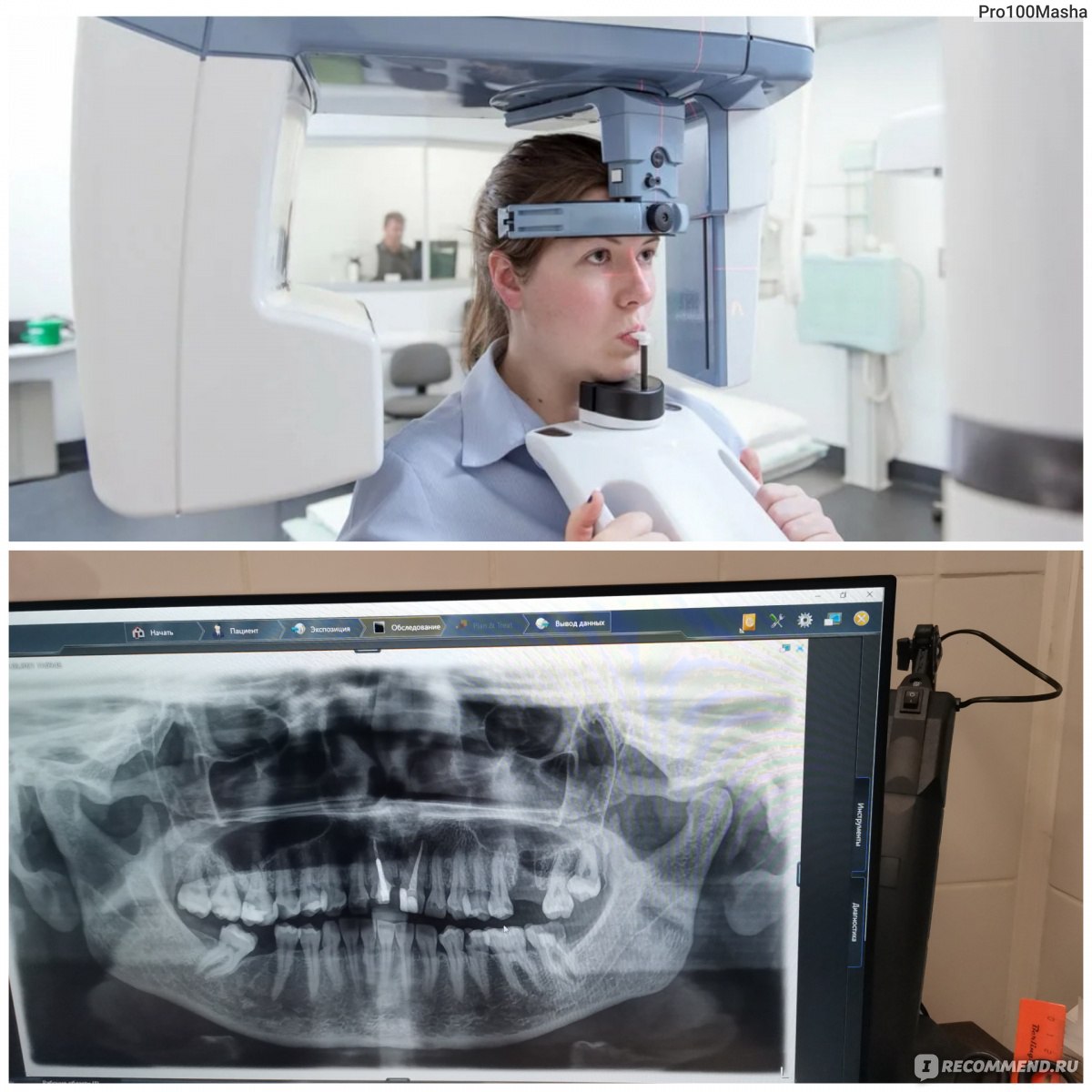 Рентгенография в стоматологии: возможности, виды и особенности диагностики