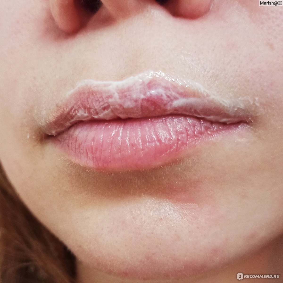 Перманентный макияж на губах и герпес на губе