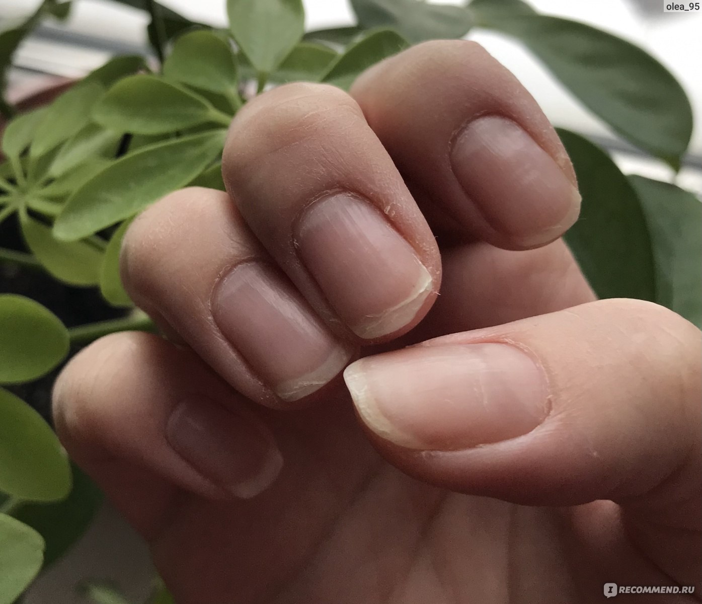 Как спасти ногти, которые слоятся и ломаются
