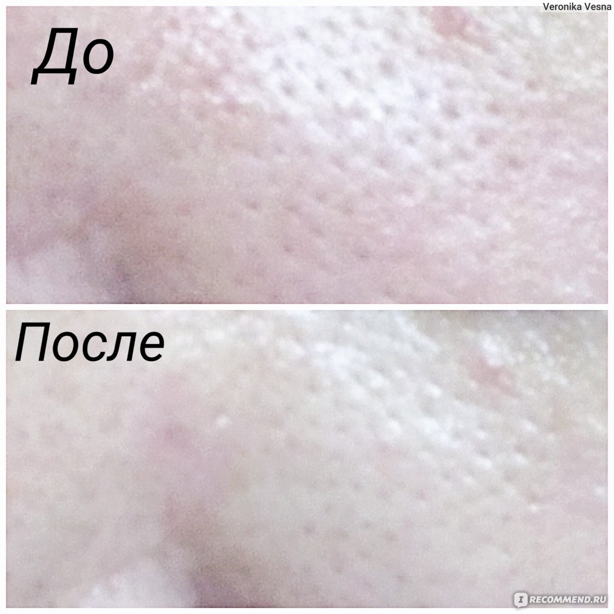 Эссенция Lanbena Сужающая поры Pore Treatment Serum Essence фото