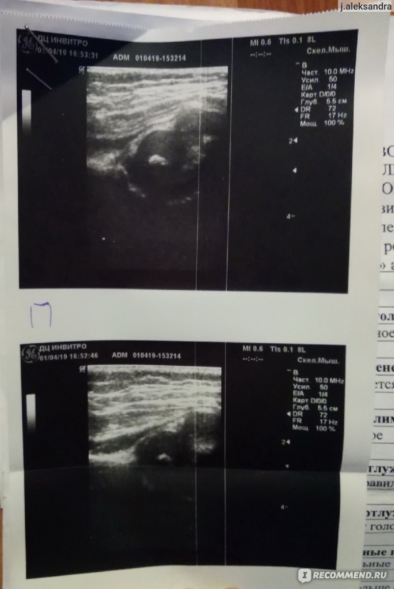 Ультразвуковое исследование (УЗИ) тазобедренного сустава - « Береги  здоровье смолоду. Исследование, которое даёт объективную картину о  состоянии здоровья » | отзывы