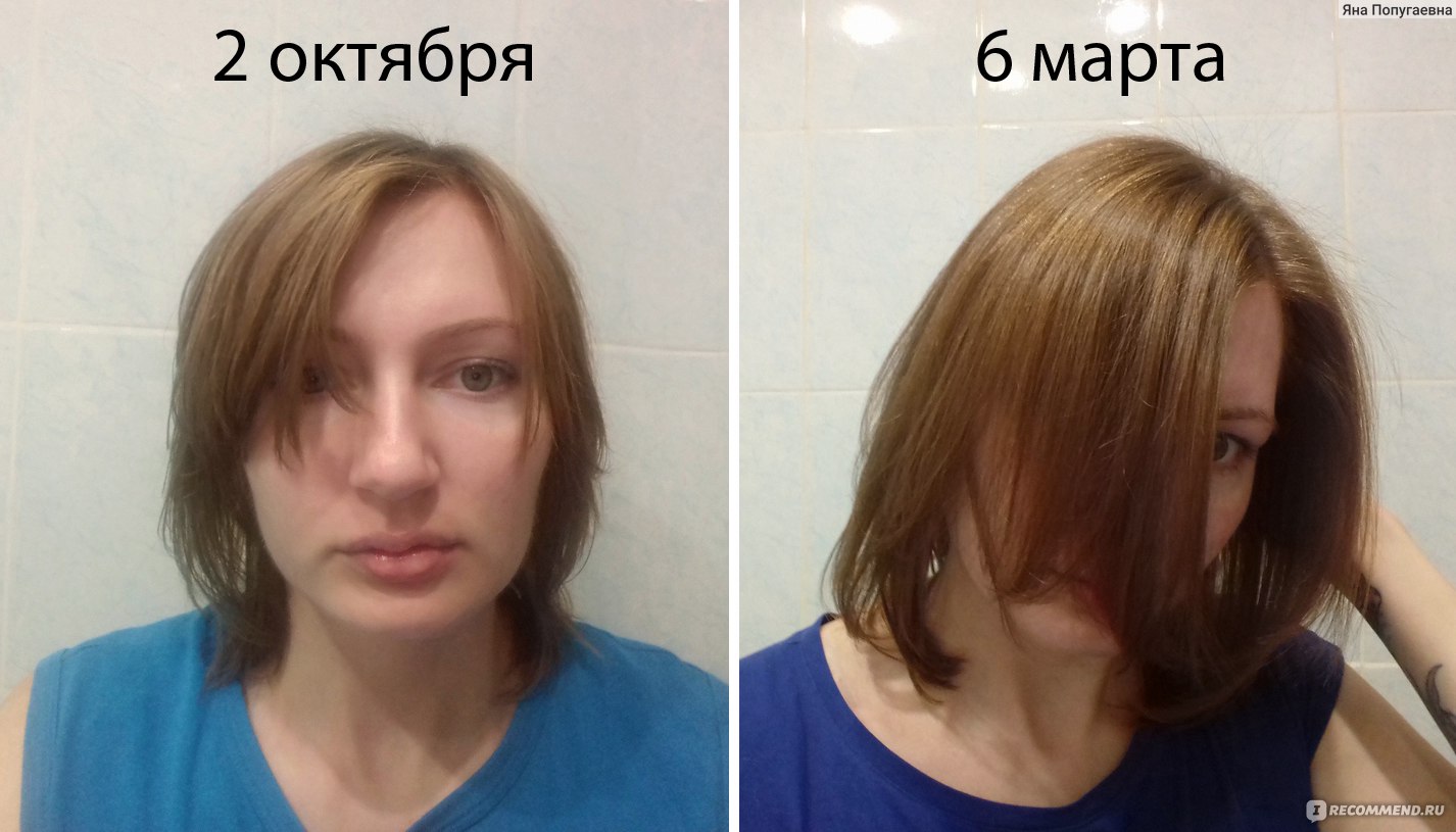 Никотиновая кислота до и после до и после волосы