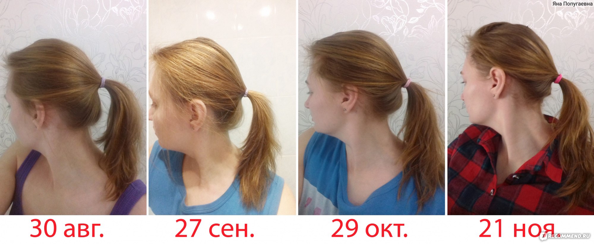 Плазмолифтинг кожи головы: цены на процедуру в Москве косметология 💫 KOSMOS