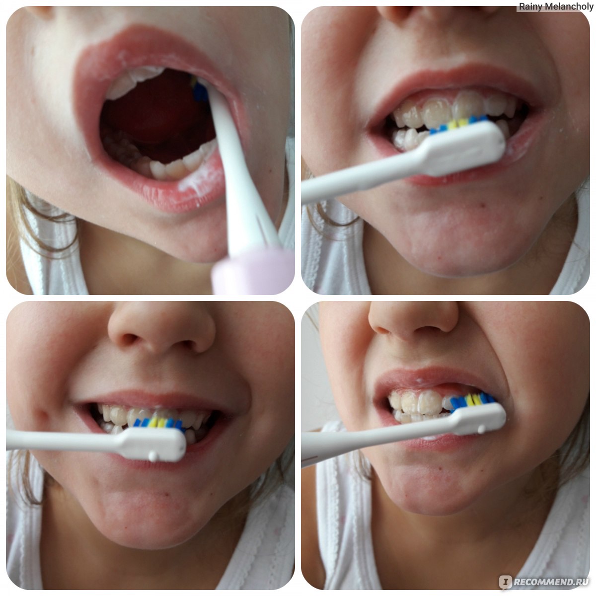 Поранил десну зубной щеткой с какого возраста можно детям пользоваться ингалятором