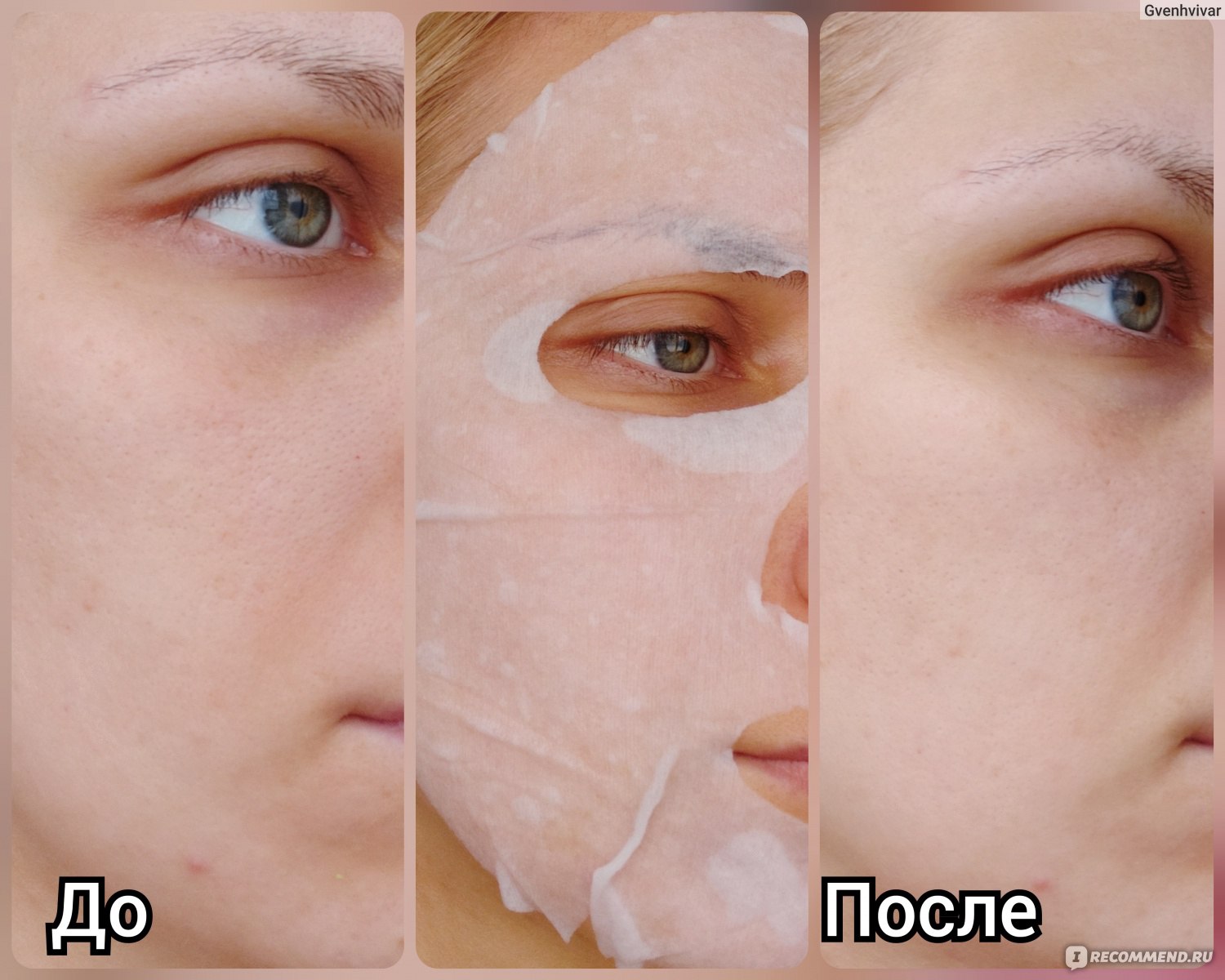Тканевые маски для лица надо ли смывать. До и после тональника. Тканевые маски до и после. Корейская маска для лица пилинг тканевая.