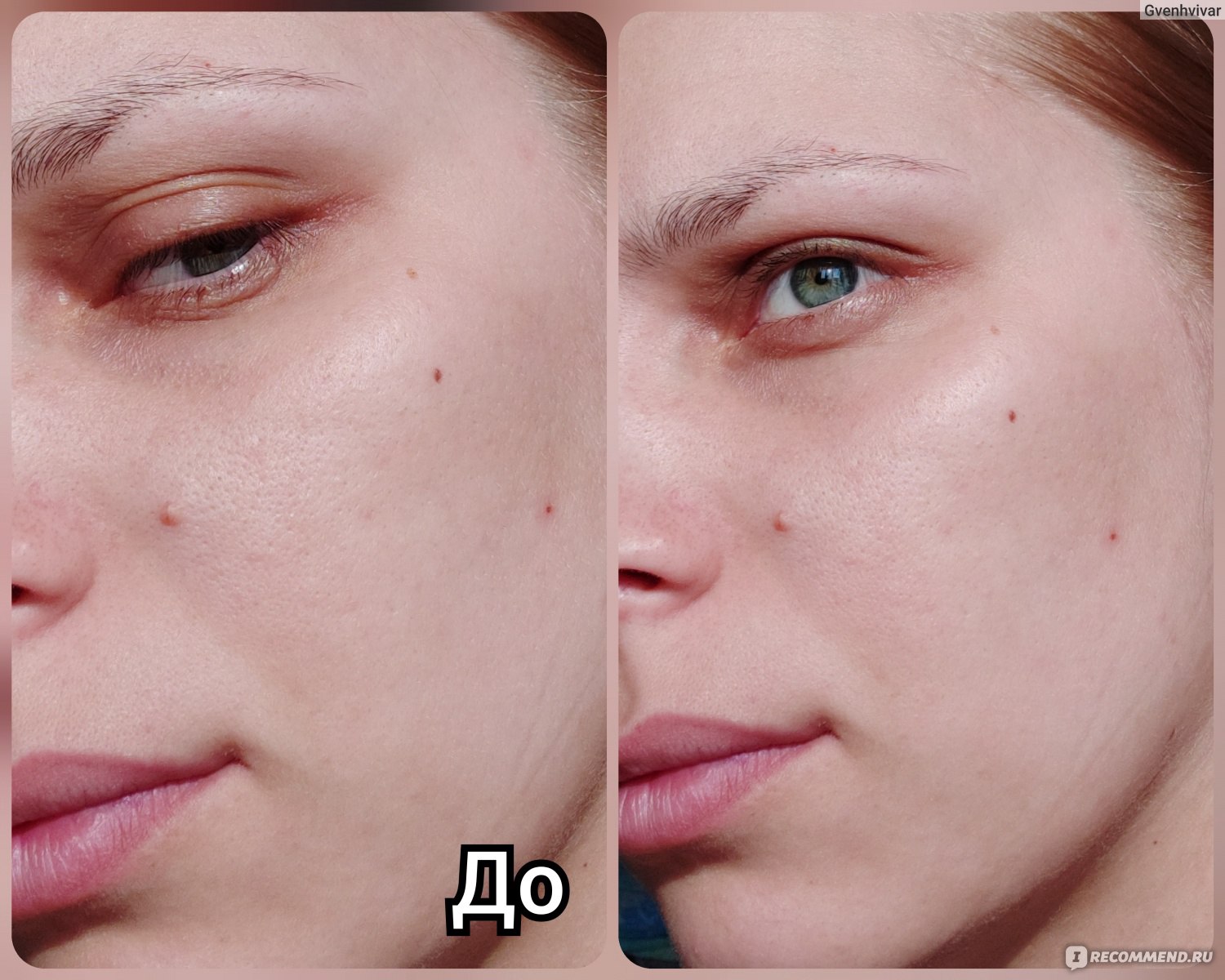 Праймер для лица фото до и после