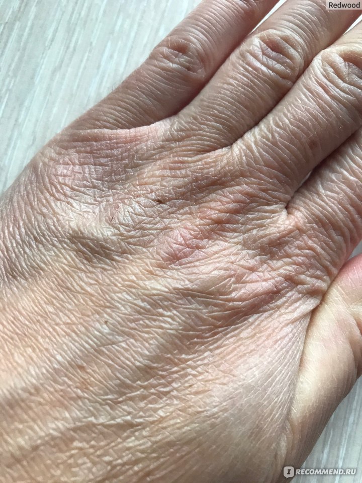 Как ухаживать за кожей рук: полезные советы