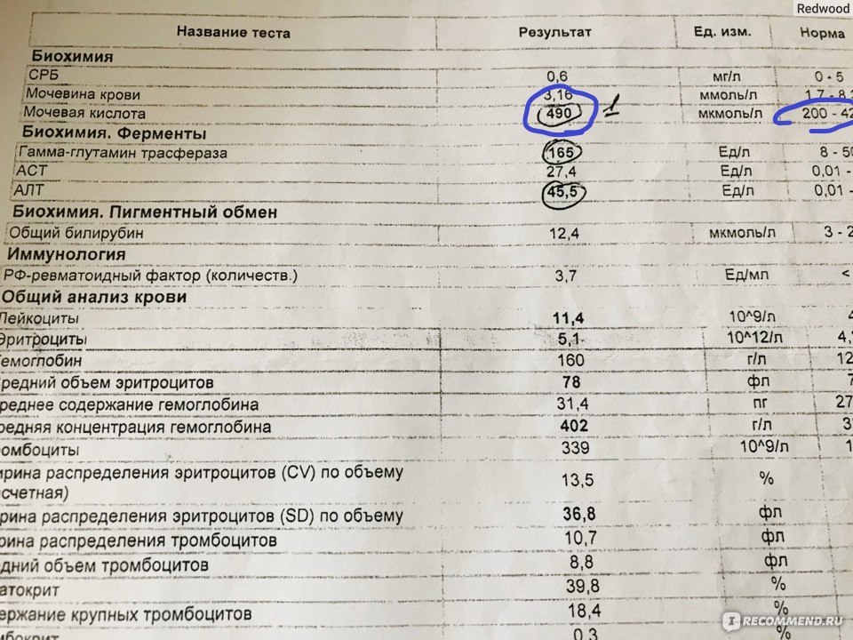 Тест на мочевую кислоту. Мочевая кислота в анализе крови что это такое.