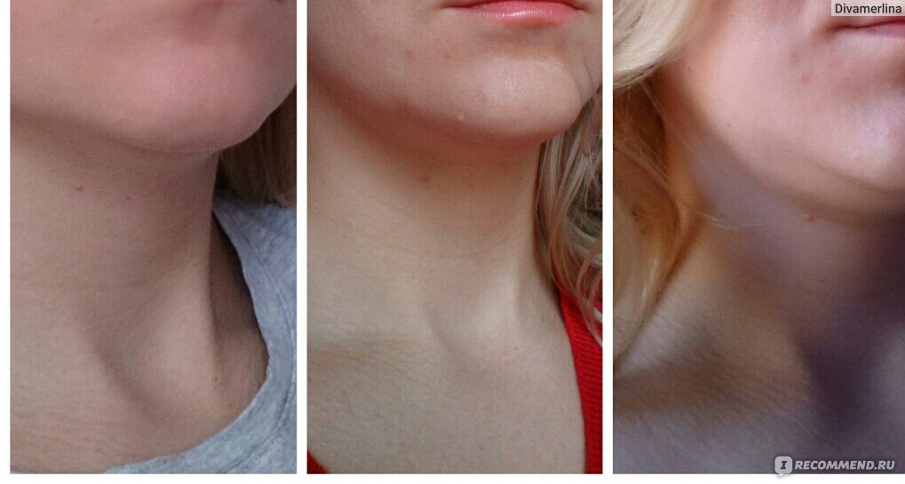 Миостимуляция лица и шеи отзывы, фото до и после в салоне красоты Balance Beauty