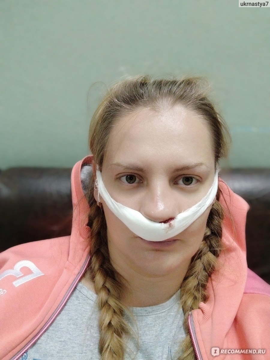 Тампоны в нос после операции