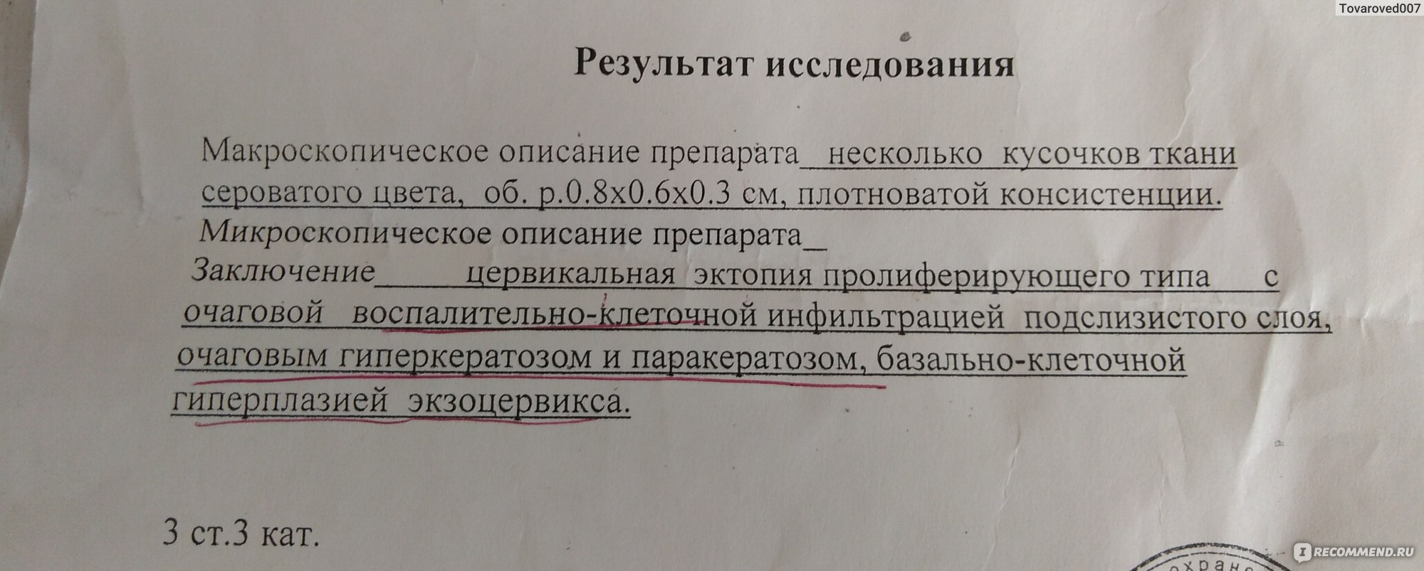 Радиоволновое лечение эрозии шейки матки - «10 лет страха перед  прижиганием, а стоило ли столько лет мучиться... Рекомендации моего врача  до и после прижигания. » | отзывы