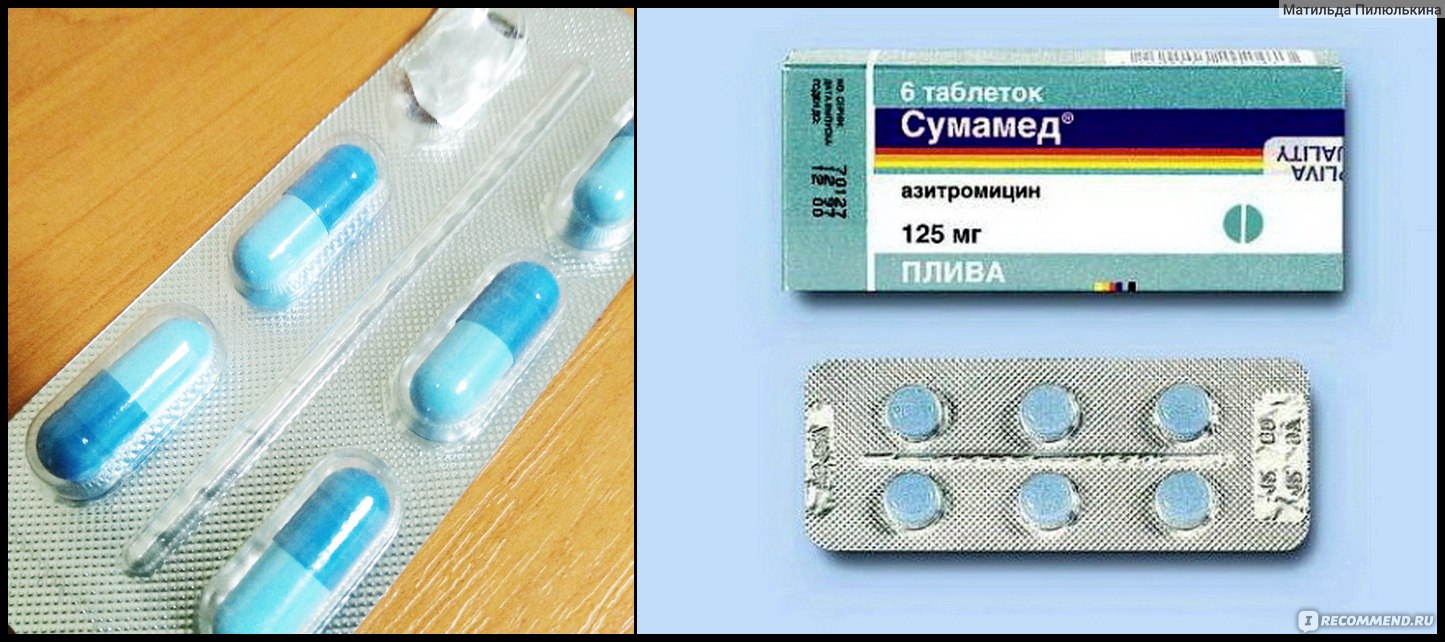 Синие таблетки от простуды. Антибиотик Сумамед 3 таблетки. Антибиотик Sumamed 3 таблетки. Antibiotic Sumamed антибиотик 3 таблетки. Антибиотик от кашля Сумам.