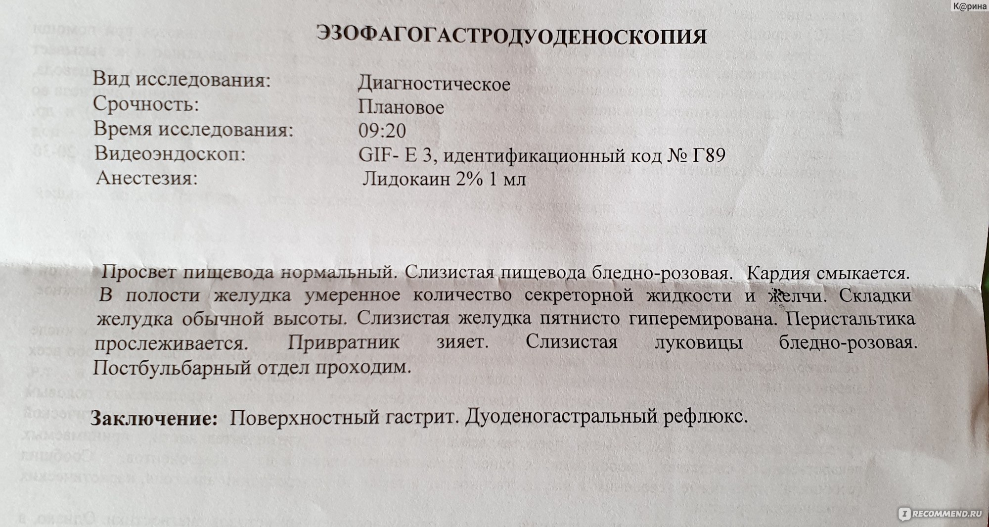 Фиброгастродуоденоскопия (ФГДС, гастроскопия) - «Рефлюкс эзофагит,  дуоденогастральный рефлюкс, гастрит, повышенная кислотность. Если у вас  есть ком в горле, тяжесть в желудке, изжега, давящая боль в груди, боль в  пищеводе, то стоит пройти