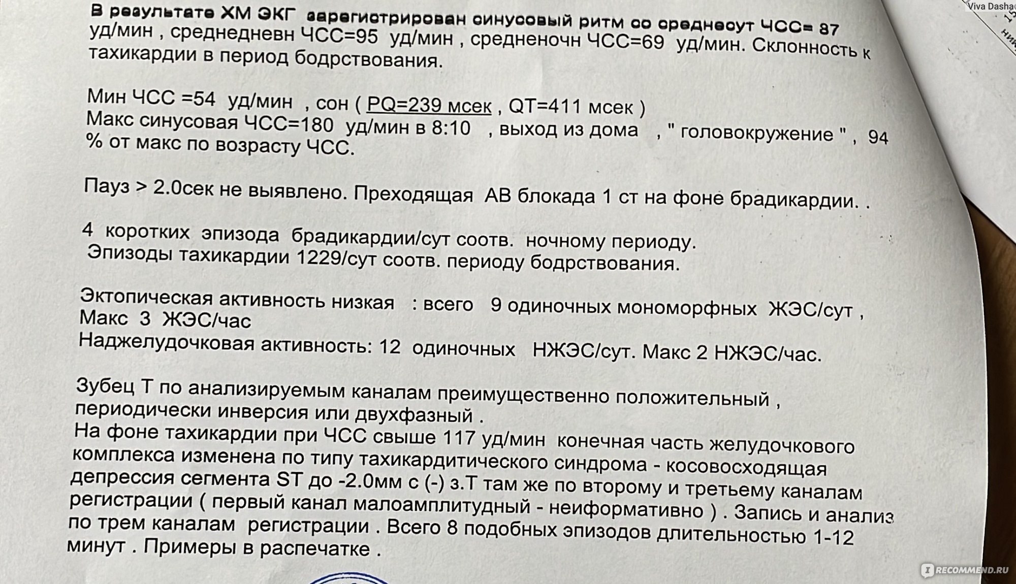 Холтеровское мониторирование ЭКГ - «Причина была как в сердце, так и в  сердечных проблемах. Как я ходила, спала и ела вся в штучках-липучках :)  Холтеровское мониторирование ЭКГ» | отзывы