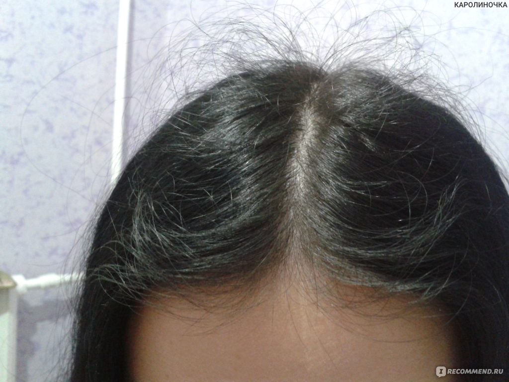 Спящие луковицы: как ускорить рост волос на голове