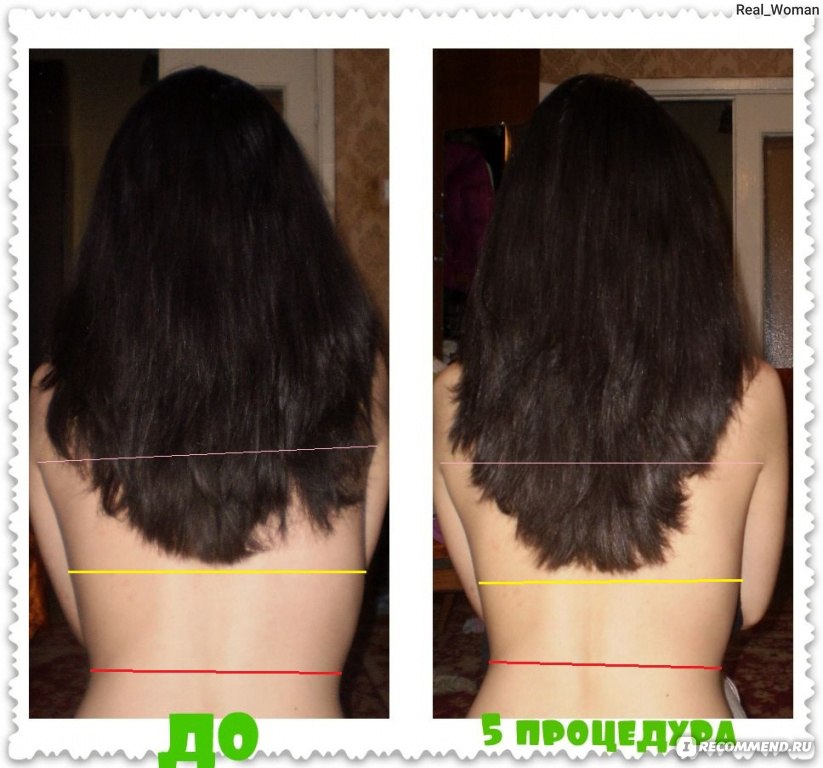 Польза репейного масла для волос до и после фото