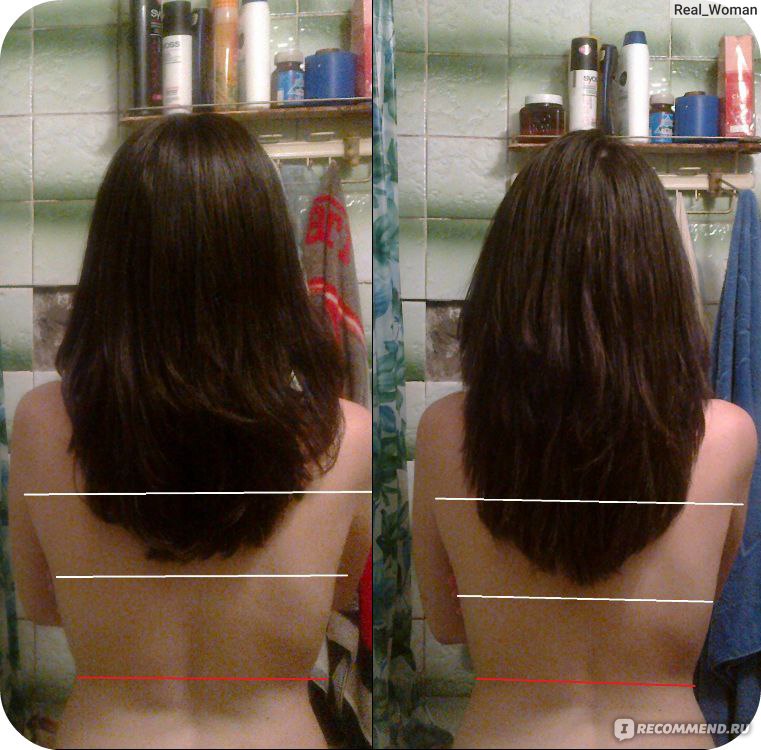 Ополаскивание крапивой. Для роста волос. Ополаскивание волос крапивой до и после. Волосы до и после рост волос. Крапива для роста волос.
