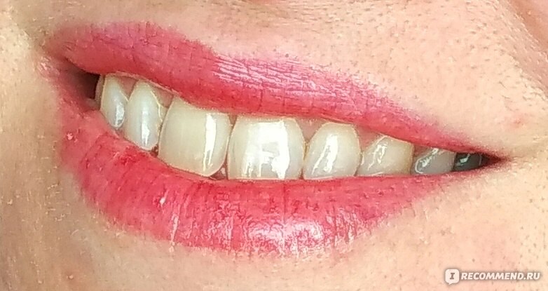 Зубная паста Colgate Безопасное отбеливание "Забота о деснах" фото