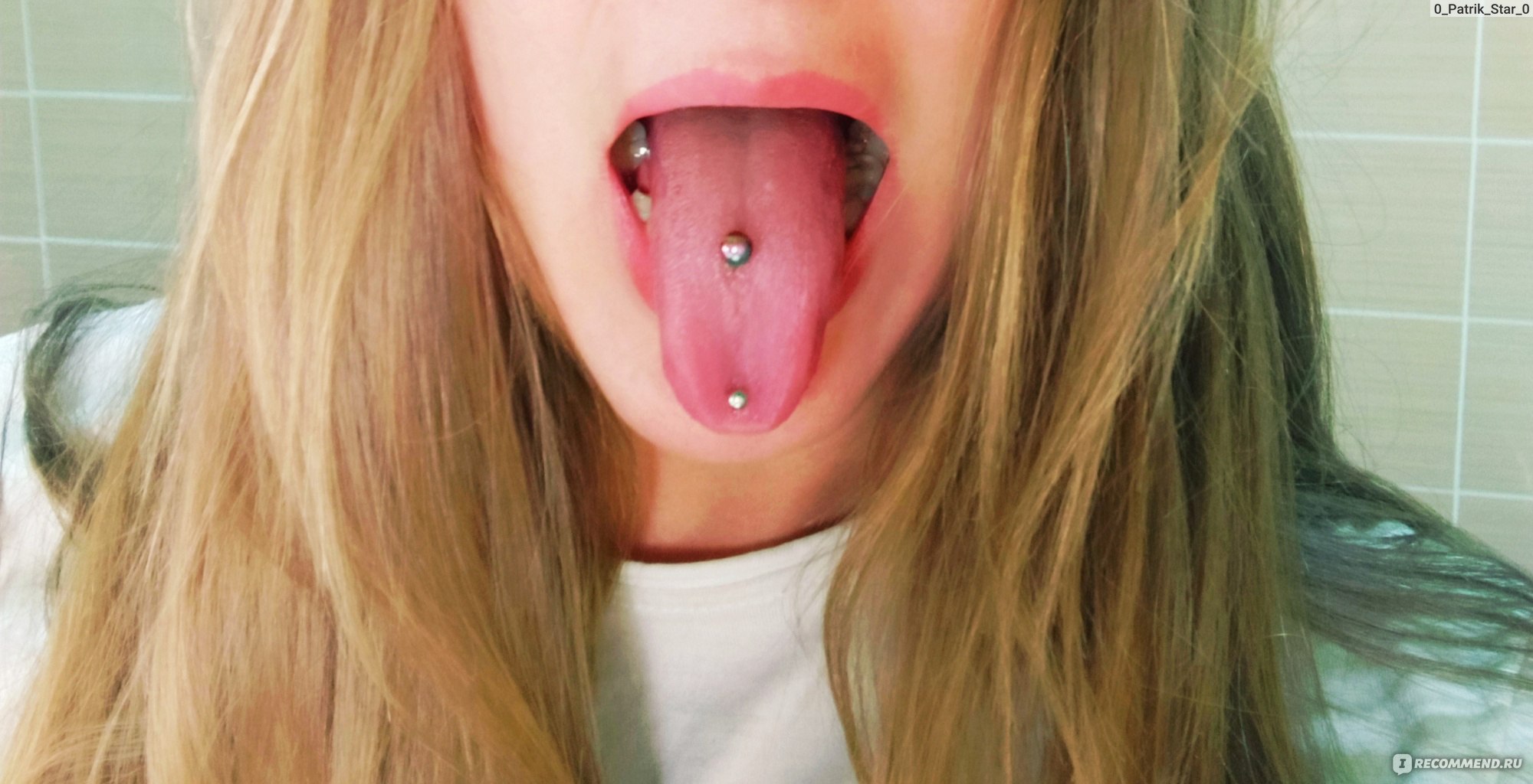 Tongue piercing gone wrong