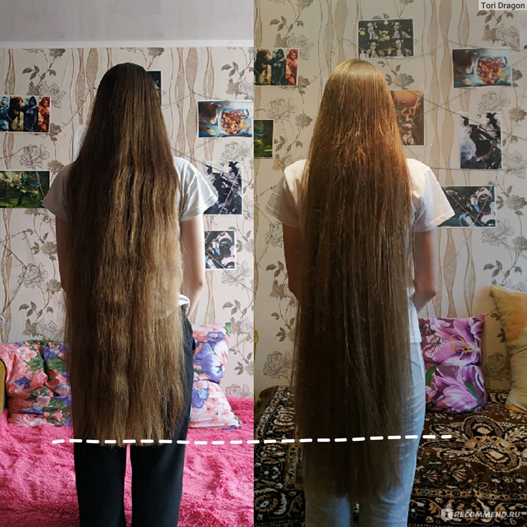 Отращивание волос + 10 см