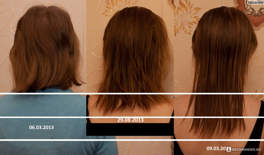 Как отрастают волосы с нуля по месяцам с фото
