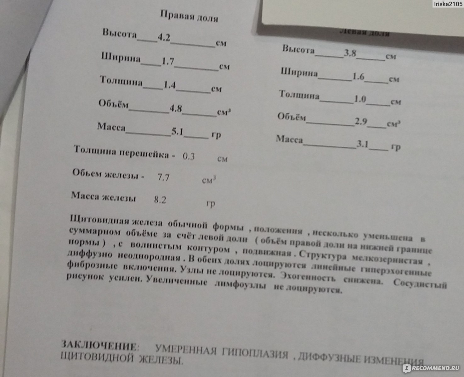 УЗИ щитовидной железы - «4 года бездействия при гипотиреозе. Как я 