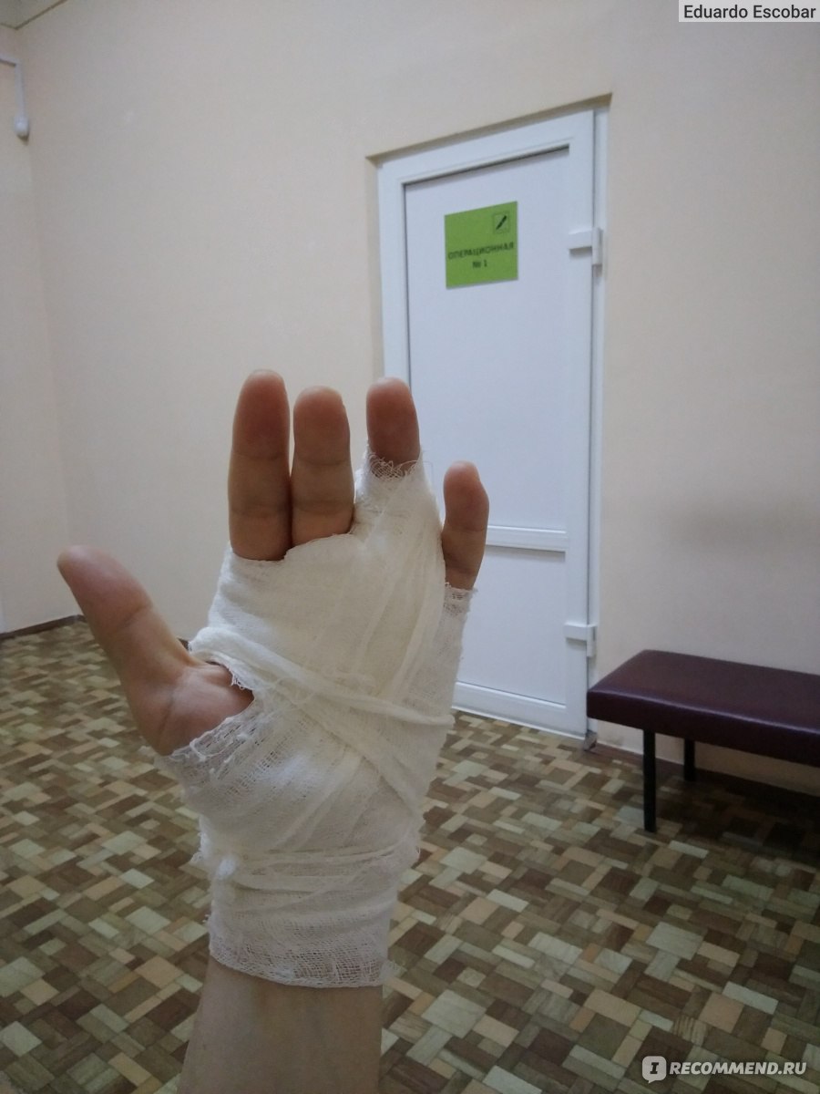Щелкающий палец – причины, симптомы, диагностика, профилактика и лечение | Врачи Онлайн