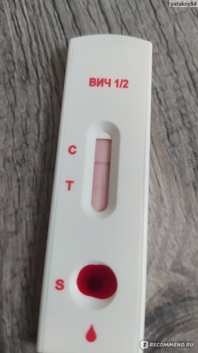 МЕД-ЭКСПРЕСС-ДИАГНОСТИКА Тест на ВИЧ 1/2/СПИД - «В СПИД-центре обнаружили  ВИЧ+, а экспресс-тест показывает 