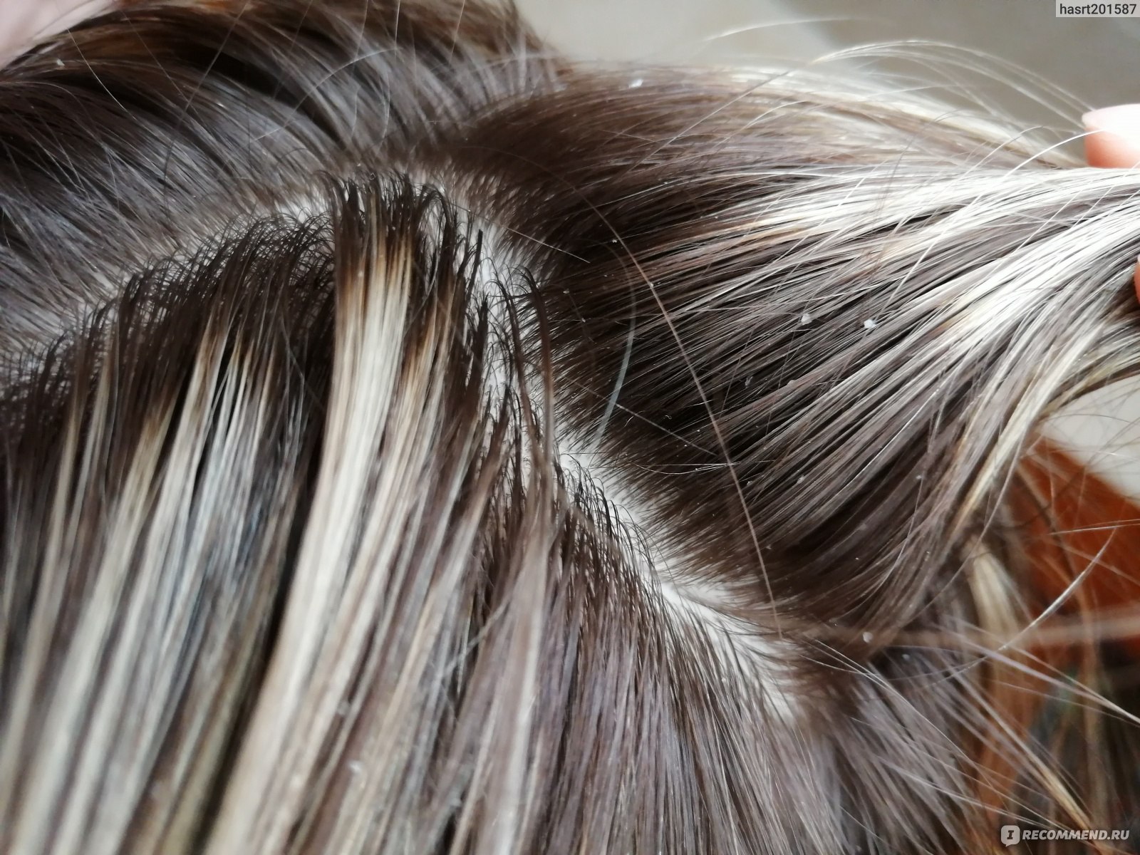 Пилинг кожи головы: скрабы, которые вернут жизнь твоим волосам