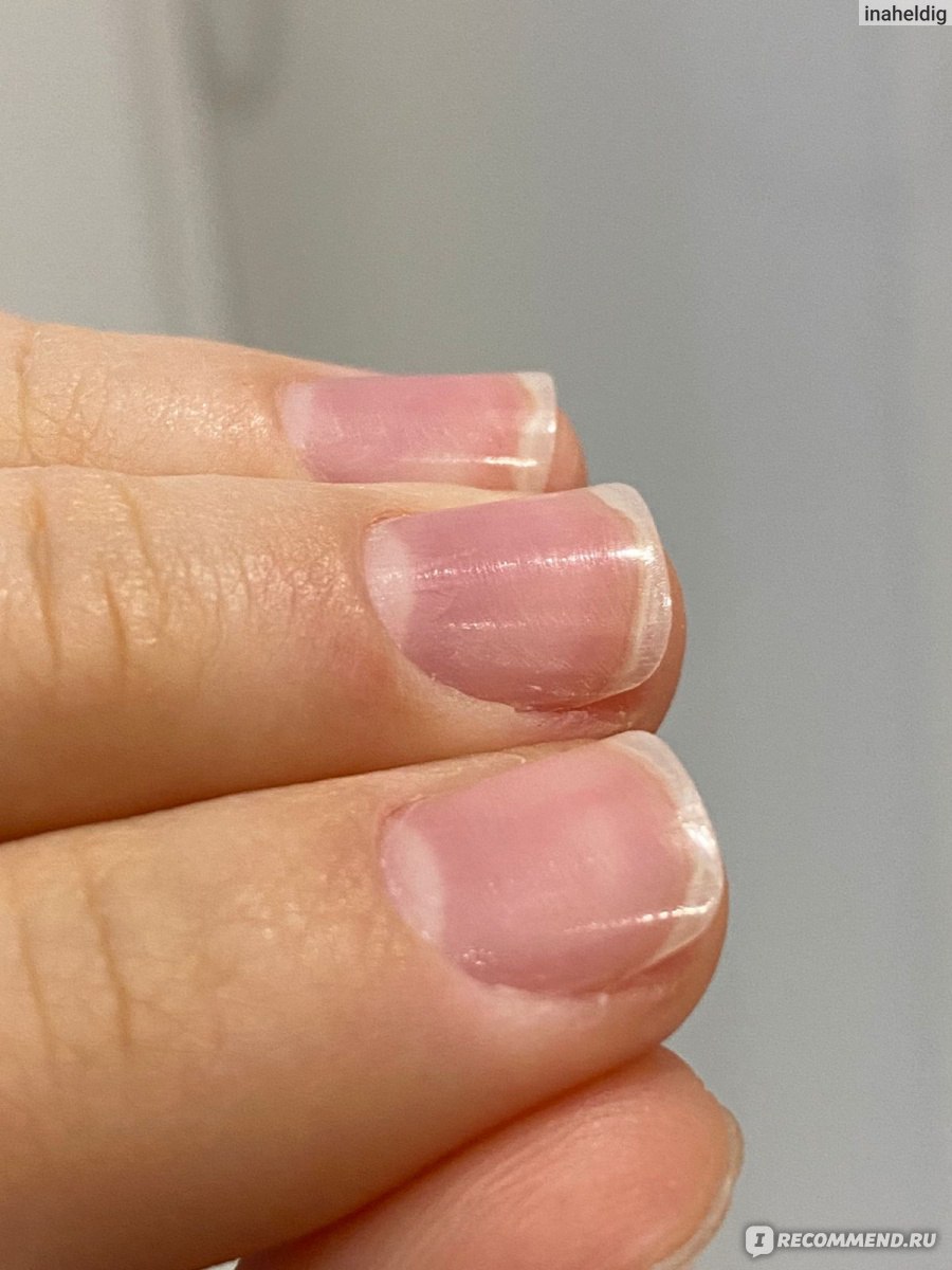 We love nails, Казань - «Приходишь за красотой, а уходишь с расцарапанной  пластиной…» | отзывы