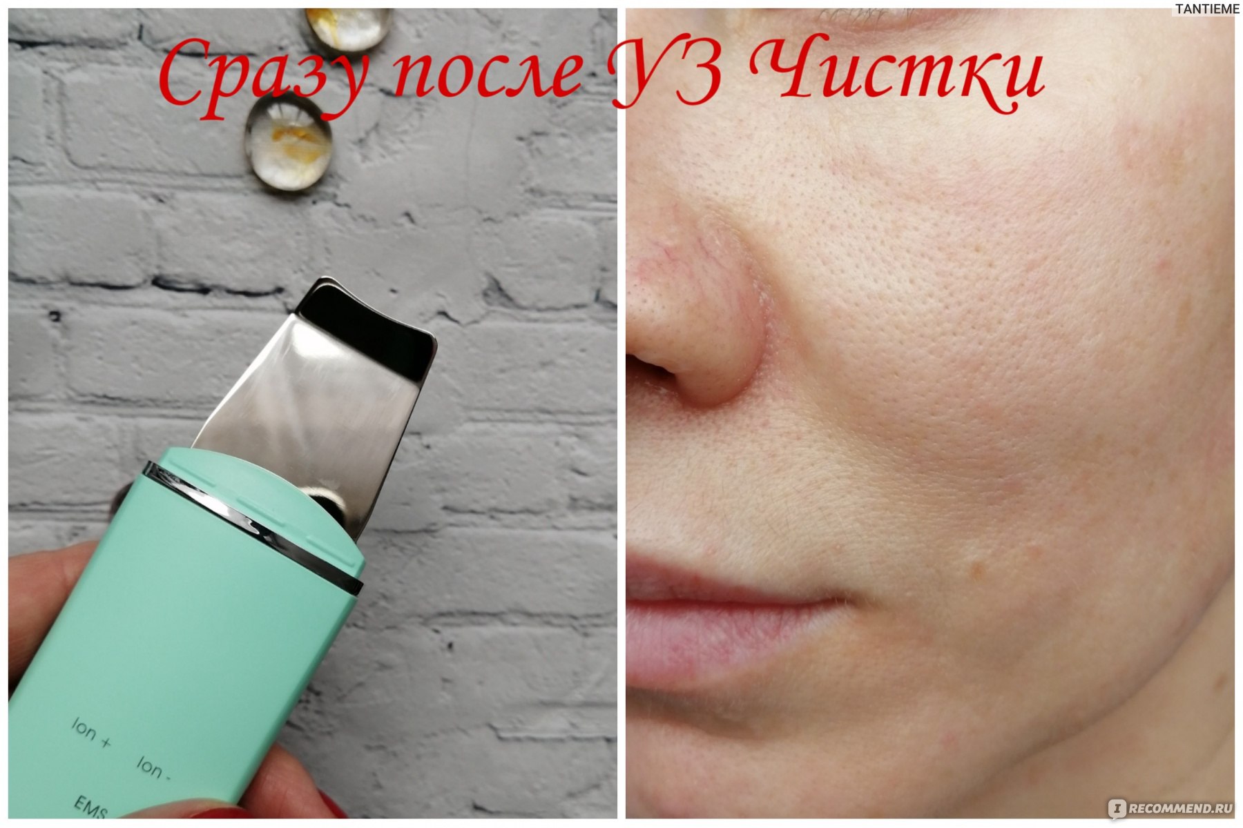 Ультразвуковой скруббер для кожи Anlan ultrasonic skin scrubber deep face cleaning machine peeling and lift  фото