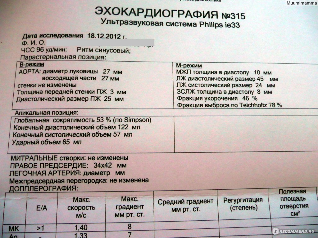 Общий план эхокардиографического обследования протокол исследования