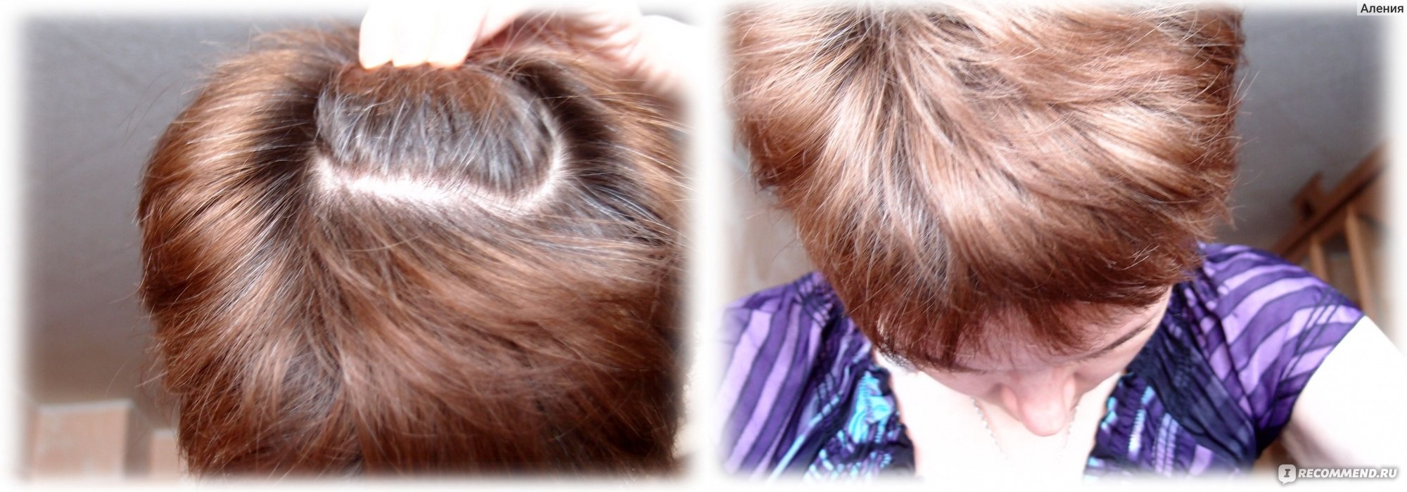 Оттенки для седых волос фото до и после