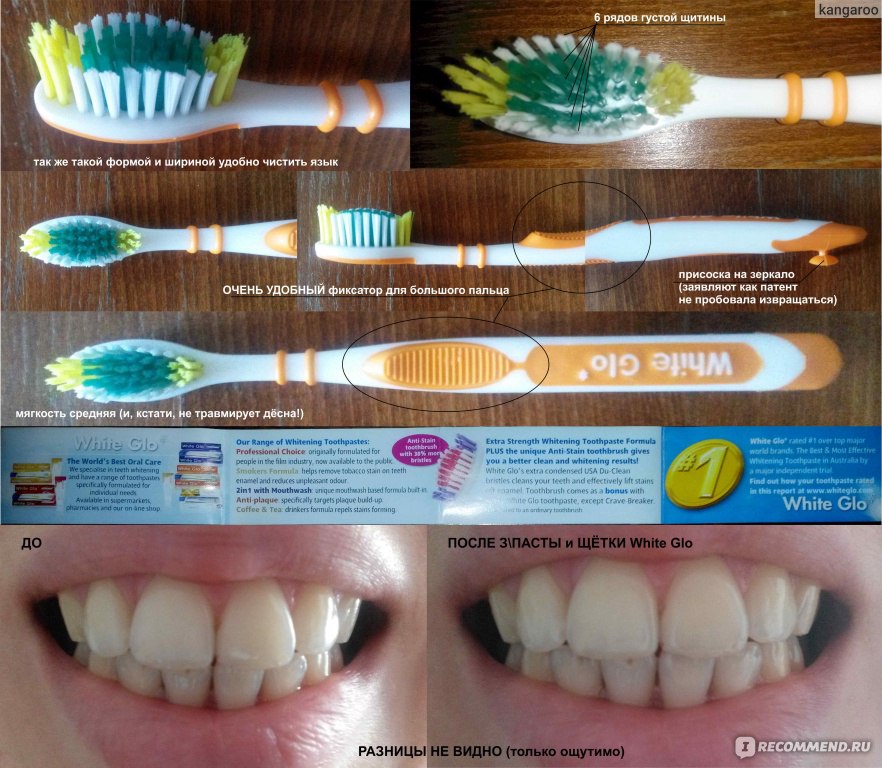 электрическая зубная щетка до и после зубы