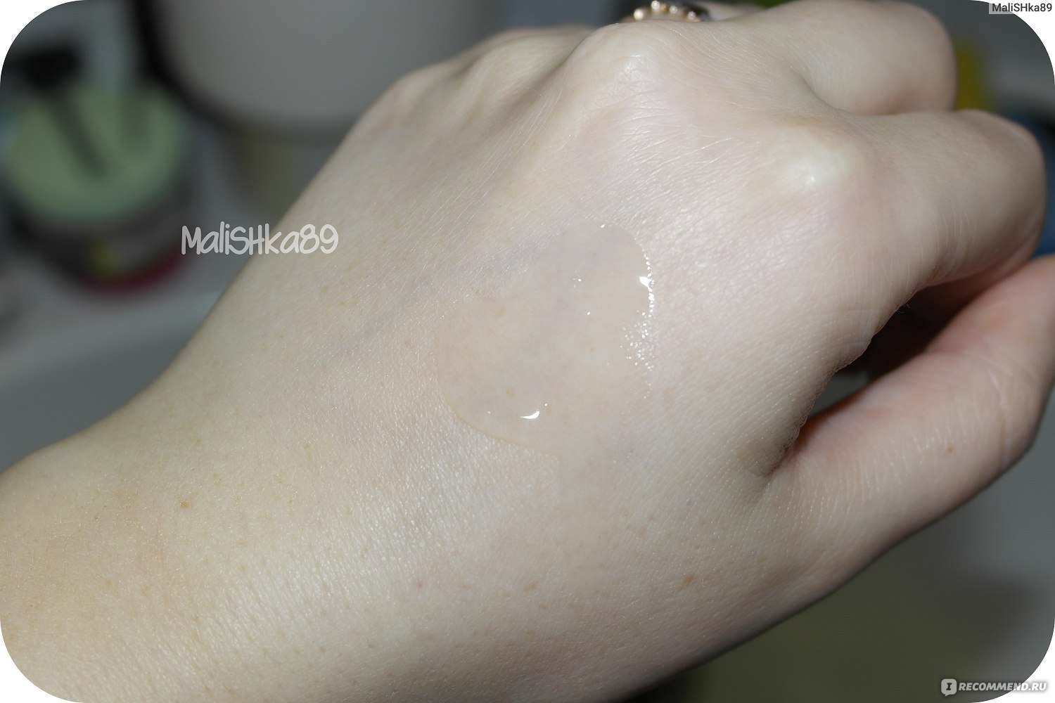 Пилинг джесснера ожог кожи. Горит лицо винирическое. Привлекательное лицо. Расширенные поры прыщи. Аллергическая маска лл для лица.