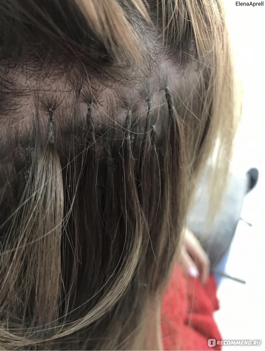 Наращивание волос после травмы
