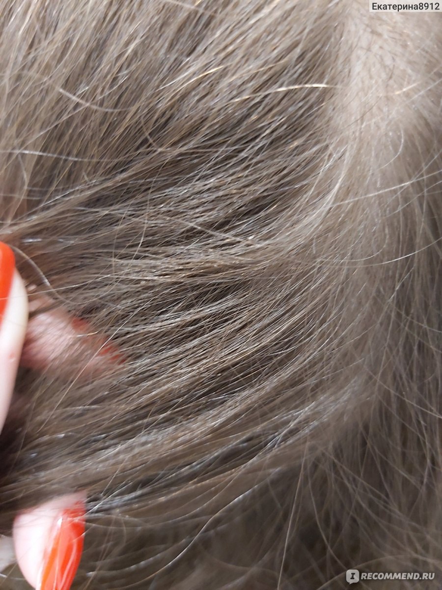 Как избавиться от гнид на волосах в домашних условиях?